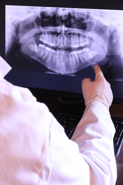 Best Knocked-Out Tooth (Avulsed Tooth) Treatment in Colbert, OK