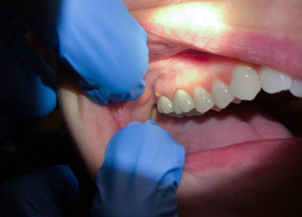 Best Emergency Cosmetic Dentistry (e.g., broken veneers) in Colbert, OK