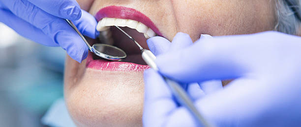 Best Broken or Chipped Tooth Repair in Colbert, OK